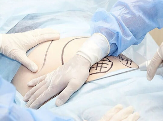 Best Hysterectomy Doctor in Ahmedabad