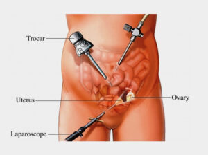 Reliable Hysterectomy Doctors in Ahmedabad