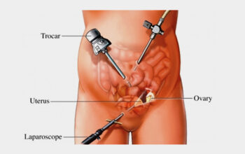 Reliable Hysterectomy Doctors in Ahmedabad