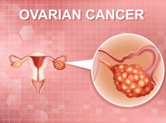 Top-rated Surgeons for Ovarian Cancer Surgery in A