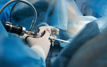 Trusted Laparoscopic Urologist Doctor in Ahmedabad