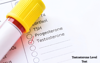Testosterone Level Test Price Guide Check Cost Eas