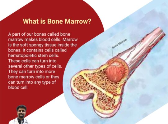 Bone marrow transplant in Hyderabad—Dr. SK Gupta