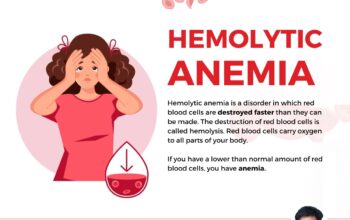 Expert Care for Anemia by Dr. S.K. Gupta: Your Tru