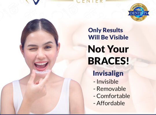 Clear Aligners in Dallas