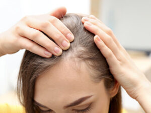 Effective & Natural Hair Loss Treatment Clinic in Noida – Restore Your Hair Today