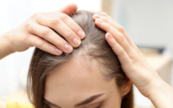 Effective & Natural Hair Loss Treatment Clinic in Noida – Restore Your Hair Today